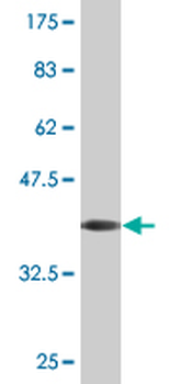 DMP1 monoclonal antibody (M01), clone 1D4