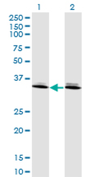 DLX6 monoclonal antibody (M06), clone 2D7