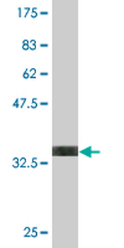 DLX6 monoclonal antibody (M06), clone 2D7