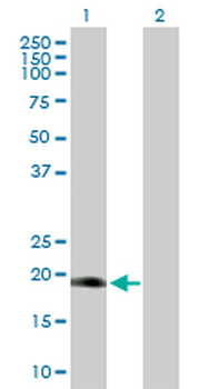 DLX6 purified MaxPab rabbit polyclonal antibody (D01P)