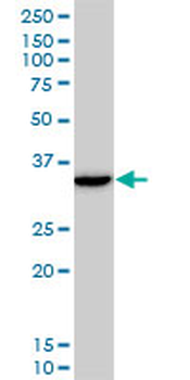 DLX5 monoclonal antibody (M12), clone 3B11
