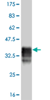 DLX5 monoclonal antibody (M12), clone 3B11