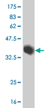 DLX5 monoclonal antibody (M09), clone 4C6