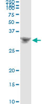 DLX4 monoclonal antibody (M01), clone 1F11
