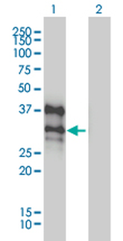 DLX4 monoclonal antibody (M01), clone 1F11