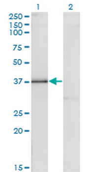 DLX3 monoclonal antibody (M09), clone 3F7