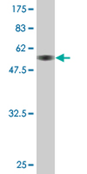 DLX3 monoclonal antibody (M09), clone 3F7