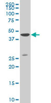 DLX3 monoclonal antibody (M03), clone 3C3