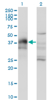 DLX3 monoclonal antibody (M03), clone 3C3