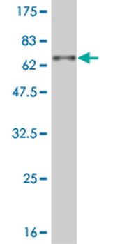 DLX3 monoclonal antibody (M03), clone 3C3