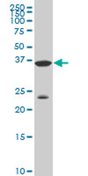 DLX3 monoclonal antibody (M02), clone 3B8