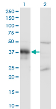DLX3 monoclonal antibody (M02), clone 3B8