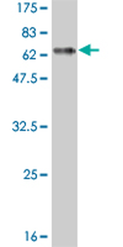 DLX3 monoclonal antibody (M02), clone 3B8