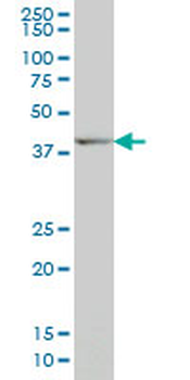 DLX2 monoclonal antibody (M06), clone 2C8