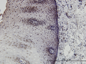 DLX2 monoclonal antibody (M06), clone 2C8
