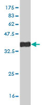DLX2 monoclonal antibody (M06), clone 2C8