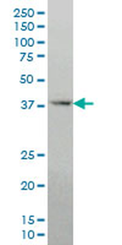 DLX2 monoclonal antibody (M05), clone 2E12