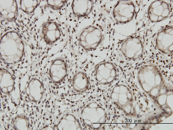 DLX2 monoclonal antibody (M05), clone 2E12