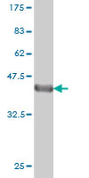 DLX2 monoclonal antibody (M05), clone 2E12