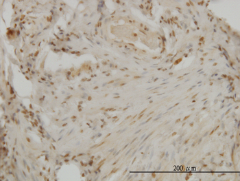 DLX2 monoclonal antibody (M04), clone 2B12