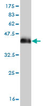 DLX2 monoclonal antibody (M04), clone 2B12