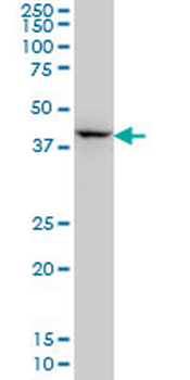 DLX2 monoclonal antibody (M02), clone 4B9