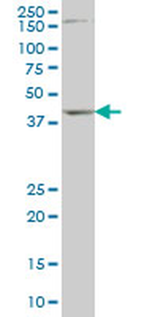 DLX2 monoclonal antibody (M01), clone 2H2