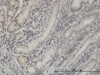 DLX2 monoclonal antibody (M01), clone 2H2