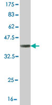 DLX2 monoclonal antibody (M01), clone 2H2