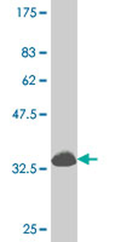 DLX1 monoclonal antibody (M15), clone 4B7