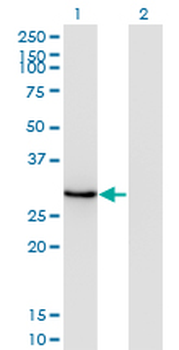 DLX1 monoclonal antibody (M14), clone 4H7