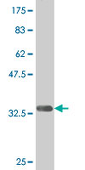 DLX1 monoclonal antibody (M14), clone 4H7