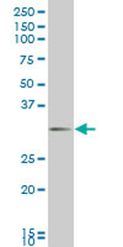 DLX1 monoclonal antibody (M12), clone 1B2