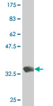 DLX1 monoclonal antibody (M12), clone 1B2