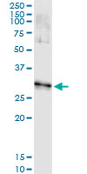DLX1 monoclonal antibody (M03), clone 3F9