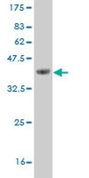 DLX1 monoclonal antibody (M03), clone 3F9