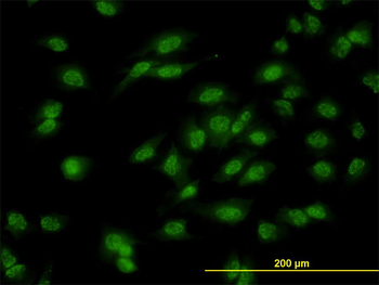 DLX1 monoclonal antibody (M01), clone 2H3