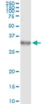DLX1 monoclonal antibody (M01), clone 2H3