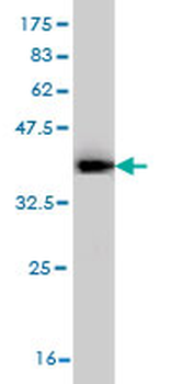 DLX1 monoclonal antibody (M01), clone 2H3
