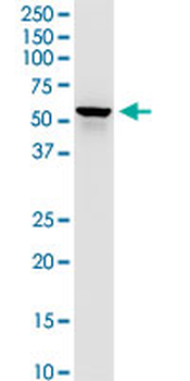 DLST monoclonal antibody (M01), clone 4D7