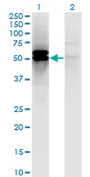 DLST monoclonal antibody (M01), clone 4D7