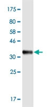 DLST monoclonal antibody (M01), clone 4D7