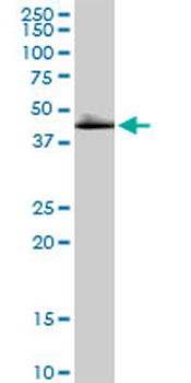 DLST MaxPab rabbit polyclonal antibody (D01)