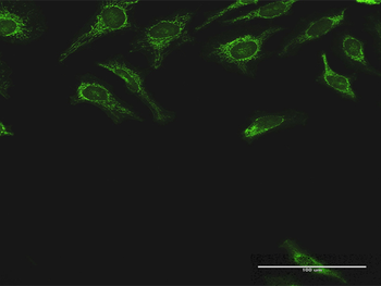 DLST MaxPab rabbit polyclonal antibody (D01)