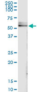 DLST MaxPab rabbit polyclonal antibody (D01)
