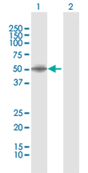 DLST MaxPab rabbit polyclonal antibody (D01)
