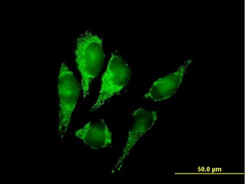 DLST purified MaxPab mouse polyclonal antibody (B01P)