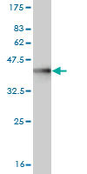 DLG3 monoclonal antibody (M03), clone 2B6