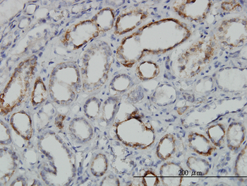 DLD monoclonal antibody (M05), clone 2D4