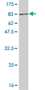 DLD monoclonal antibody (M05), clone 2D4